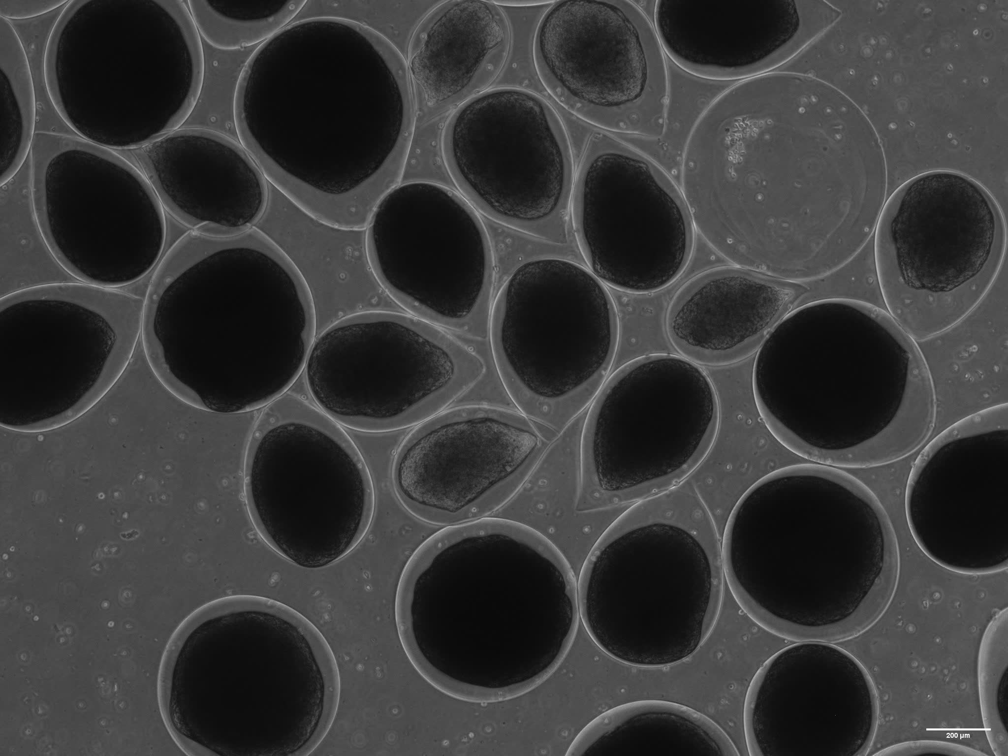 NK cells — donor-derived