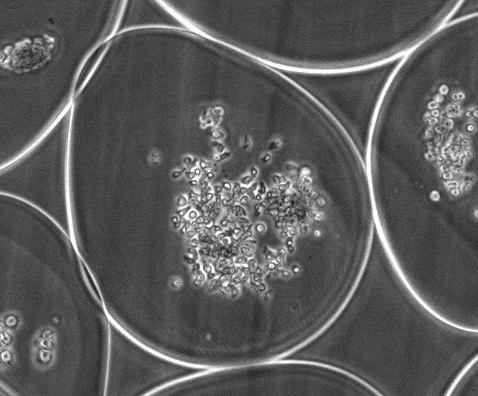 NK cells — hiPSC-derived