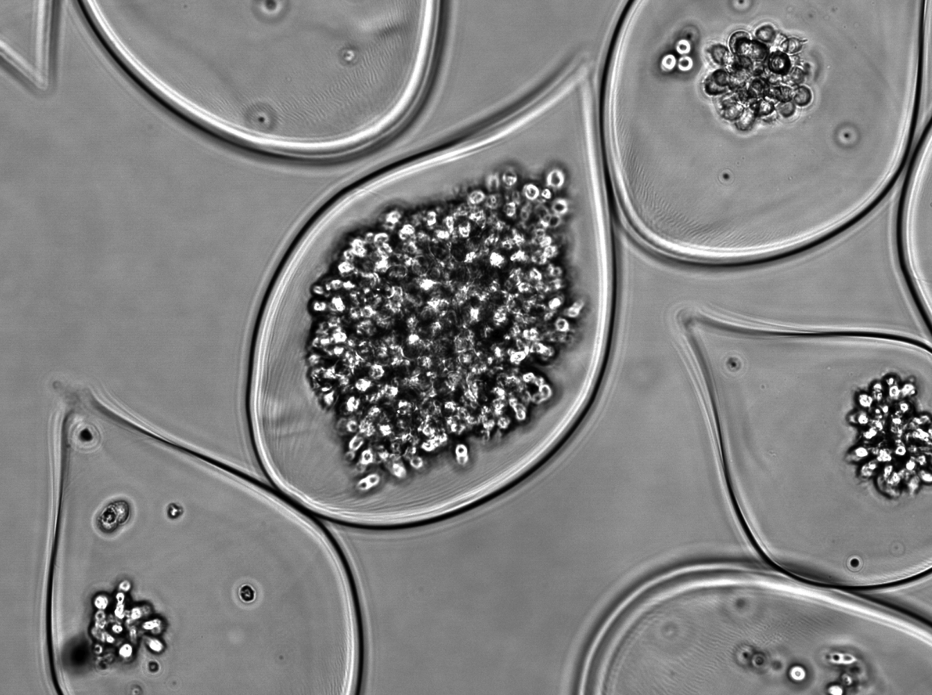 T cells — donor-derived